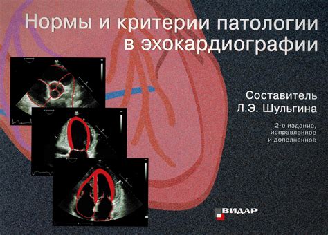 Возможные причины отсутствия патологии при эхокардиографии