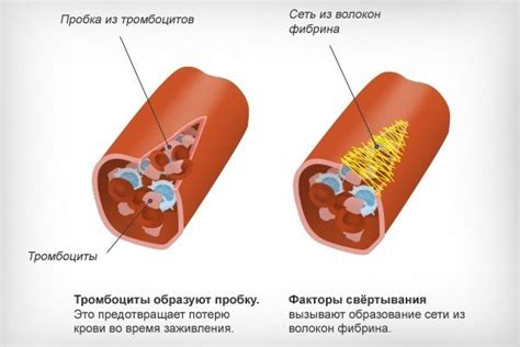 Возможные причины повышения ЦРБ крови