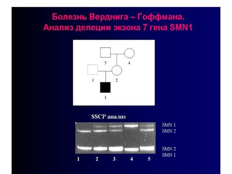 Возможные причины появления дополнительных копий гена smn1