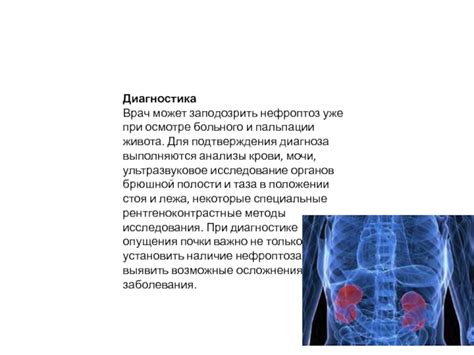 Возможные причины развития нефроптоза