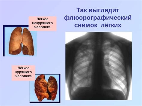 Возможные проблемы, связанные с корнями легких