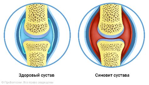 Возникновение и строение синовиальной оболочки