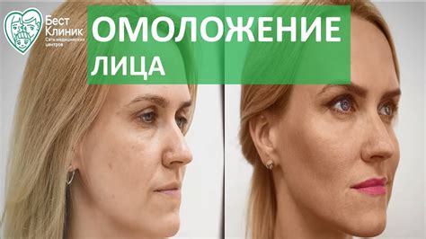 Возрастные изменения в выходном зрачке