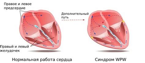 Волчаночноподобный синдром: причины, симптомы и лечение