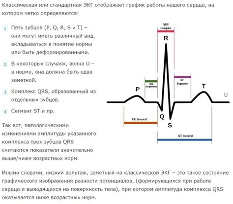 Вольтаж ЭКГ: что это означает