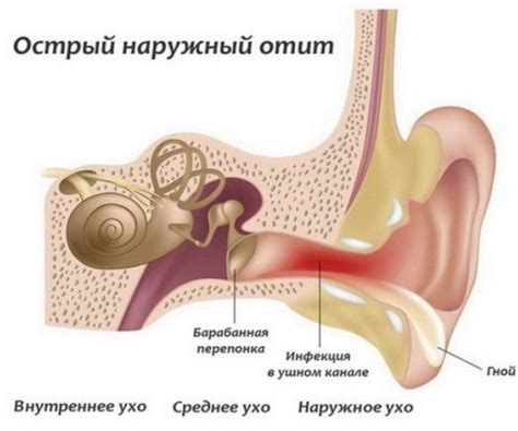 Воспаление уха: почему оно возникает?