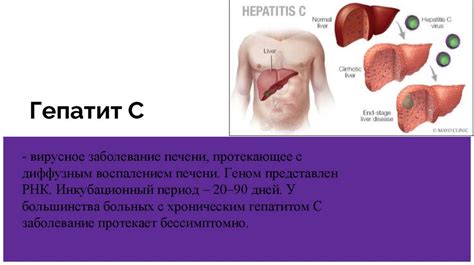 Воспалительные заболевания печени