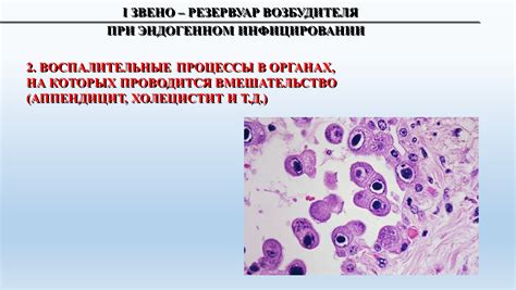 Воспалительные процессы в органах репродуктивной системы