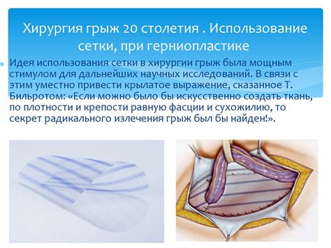 Вправляемая паховая грыжа: полезная информация для вас!