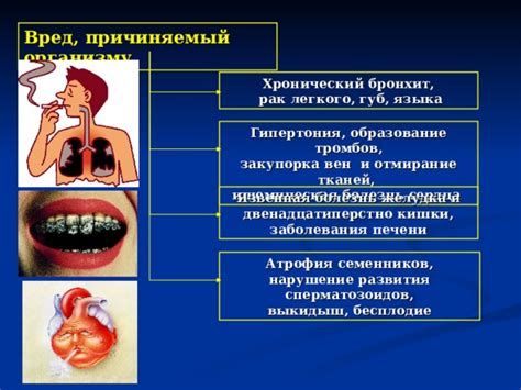 Вред, причиняемый глотке и горлу