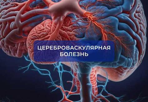 Врожденные аномалии головного мозга