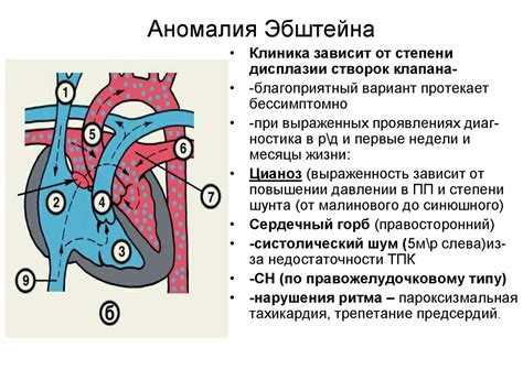 Врожденные аномалии и кувыркающееся сердце