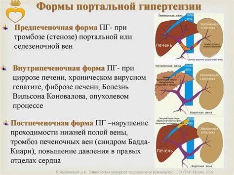 Врожденные аномалии и патологии, вызывающие усиление портального рисунка печени