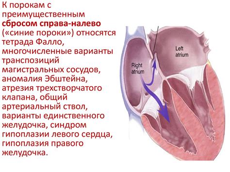 Врожденные пороки сердца