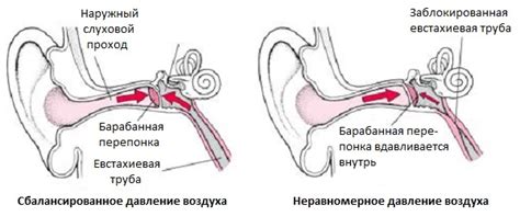 Вследствие нарушения давления в среднем ухе