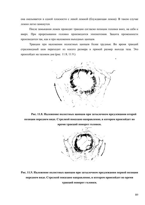 Вторая позиция