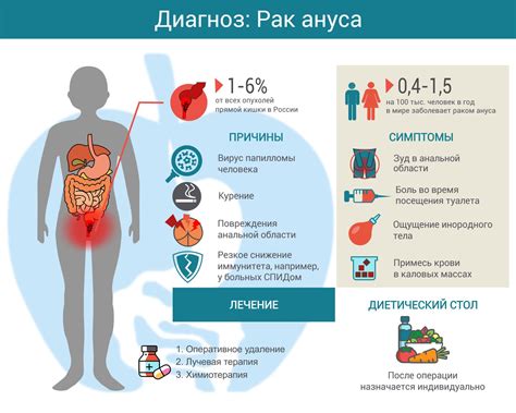 Вторичный рак: причины, симптомы, методы лечения