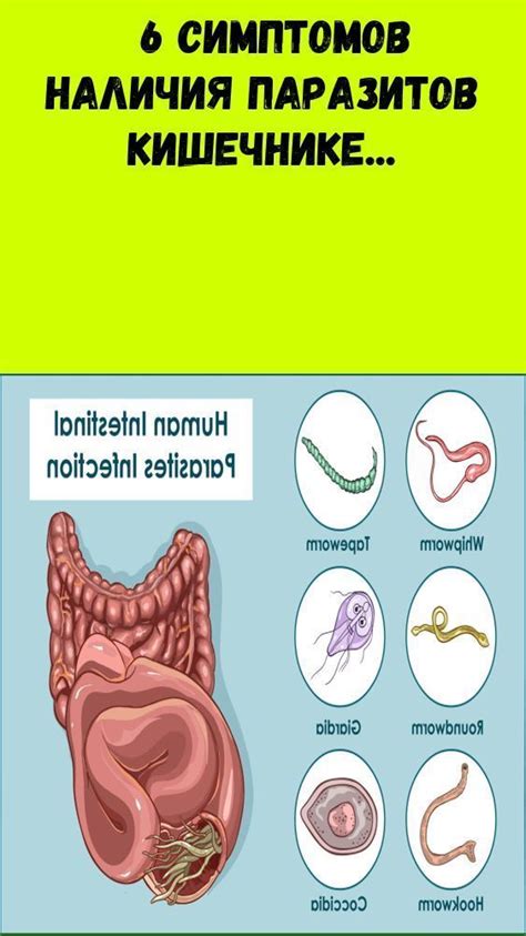 Выявление наличия паразитов в кишечнике: способы и признаки