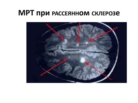 Выявление специфических состояний с контрастным веществом