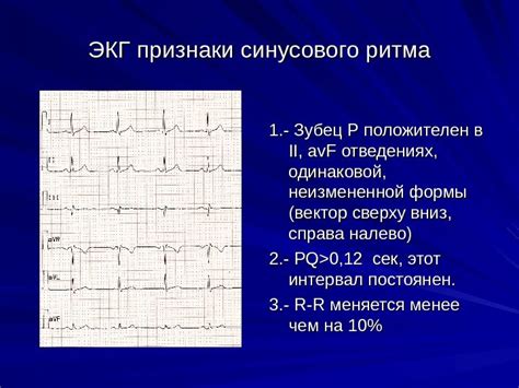 В чем заключается значение синусового ритма?