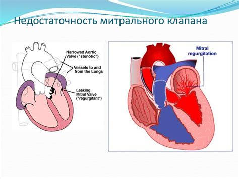 В чем причины ощущения биения сердца