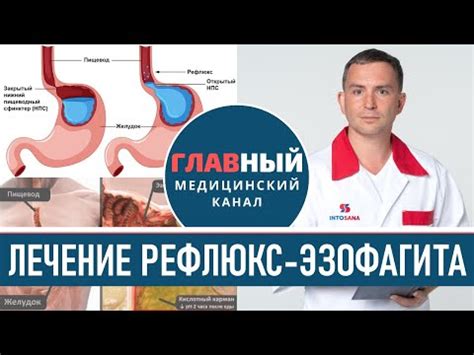 Гастроэзофагальный рефлюкс - диагностика и лечение