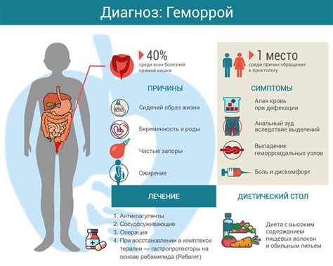 Геморрой: причины, симптомы, методы лечения