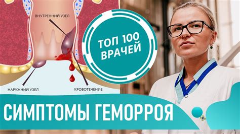 Геморрой - что это и как возникает