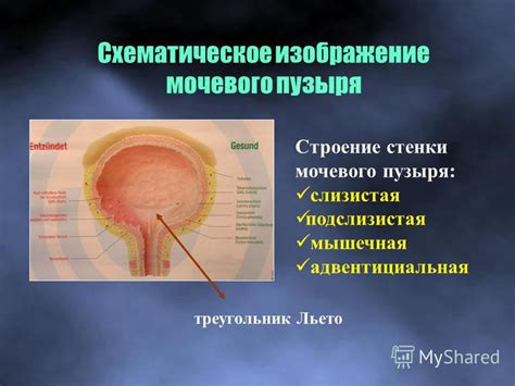 Генетические и врожденные факторы, влияющие на уплотнение стенки мочевого пузыря у мужчин