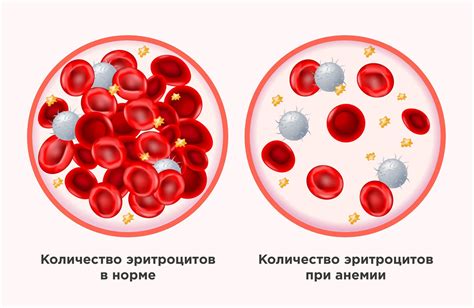 Генетические нарушения образования эритроцитов