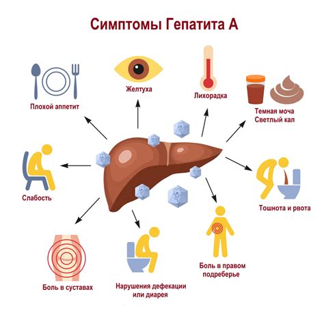 Гепатит А: симптомы, причины, диагностика