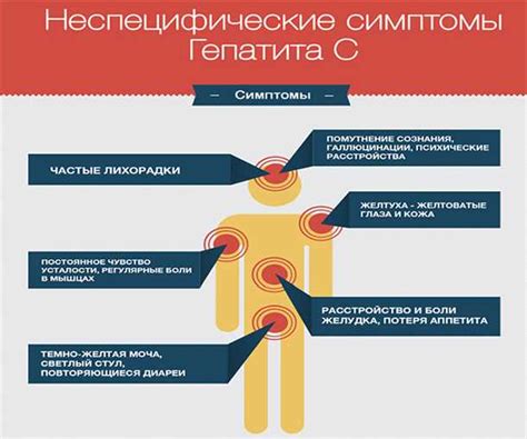 Гепатит С: симптомы и признаки у женщин