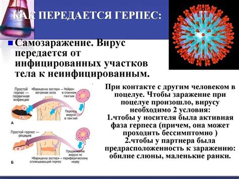 Герпетическая инфекция: симптомы, причины и лечение