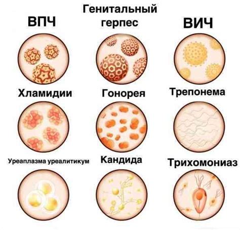 Гигиенические меры для предотвращения заражения волдырей