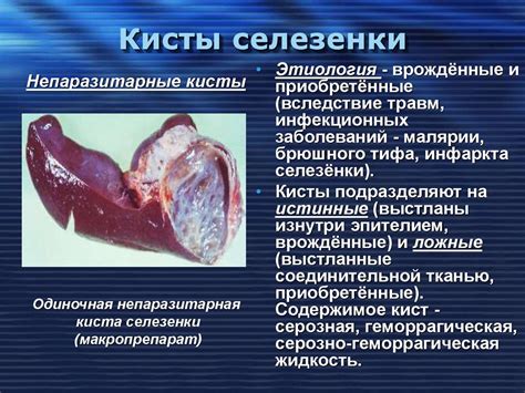 Гиповаскулярные образования селезенки: симптомы и лечение