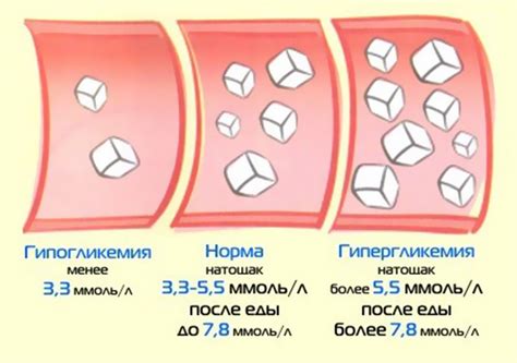 Гипогликемия при сахарном диабете