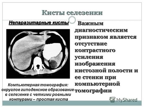 Гиподенсное образование в селезенке