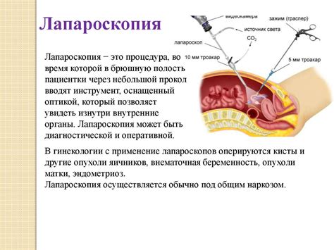 Гистология в гинекологии: основные принципы и методы исследования