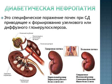 Главные особенности патологического субстрата