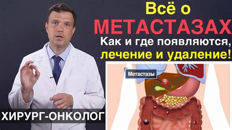 Главные причины образования метастазов