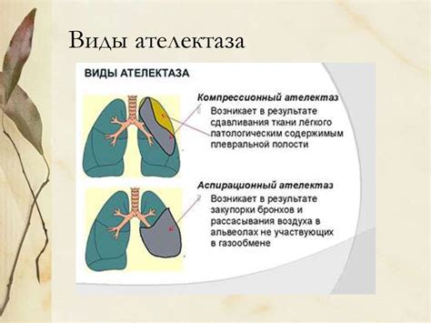 Главные причины тотального ателектаза легкого