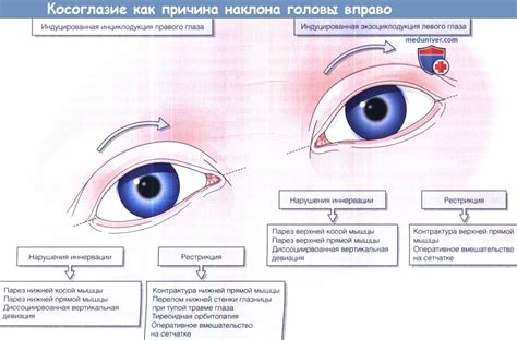 Глазные причины