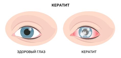 Глазные проблемы и инфекции