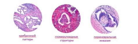 Глиссона шкала: определение и применение