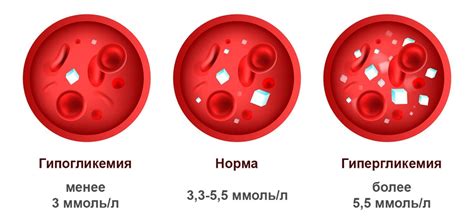 Глюкоза в сыворотке крови: основные аспекты и значение анализа