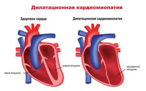 Головокружение при сердечных проблемах