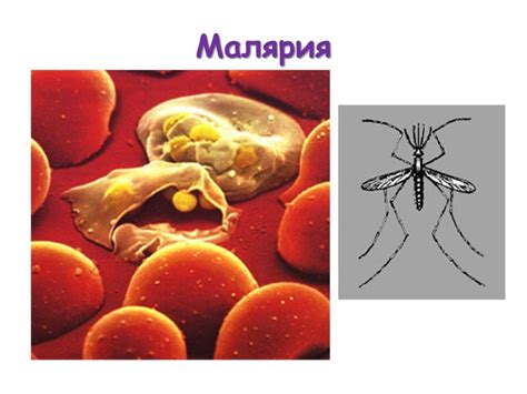 Горечь при малярии