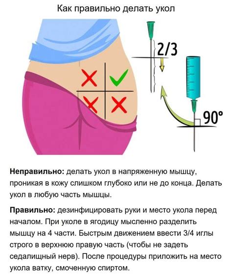 Горячий укол в ягодицу: зачем?