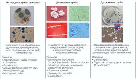 Грибковые инфекции и микозы