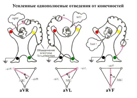 Грудные электроды: роль, применение и значение в ЭКГ исследованиях